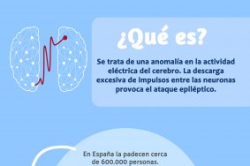 Epilepsia: qué es y cómo actuar ante un ataque